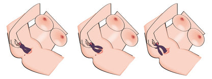 15-Elegant Vibrator Double Vibe-15