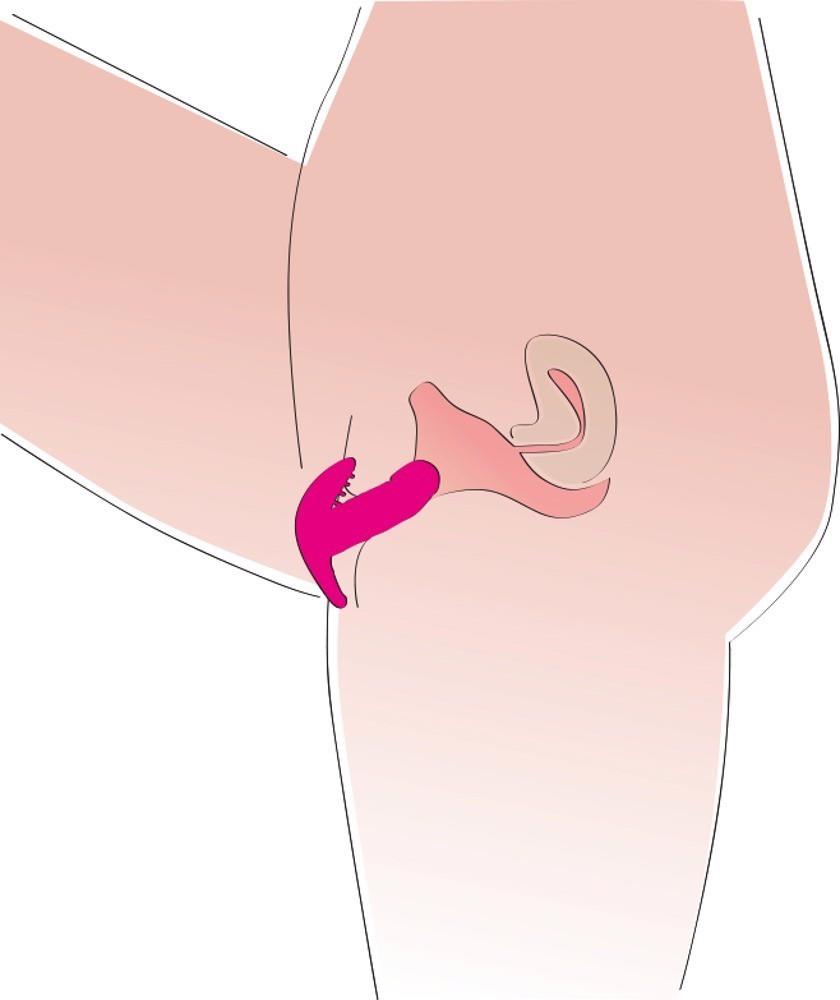 16-My Little Secret silicone-16